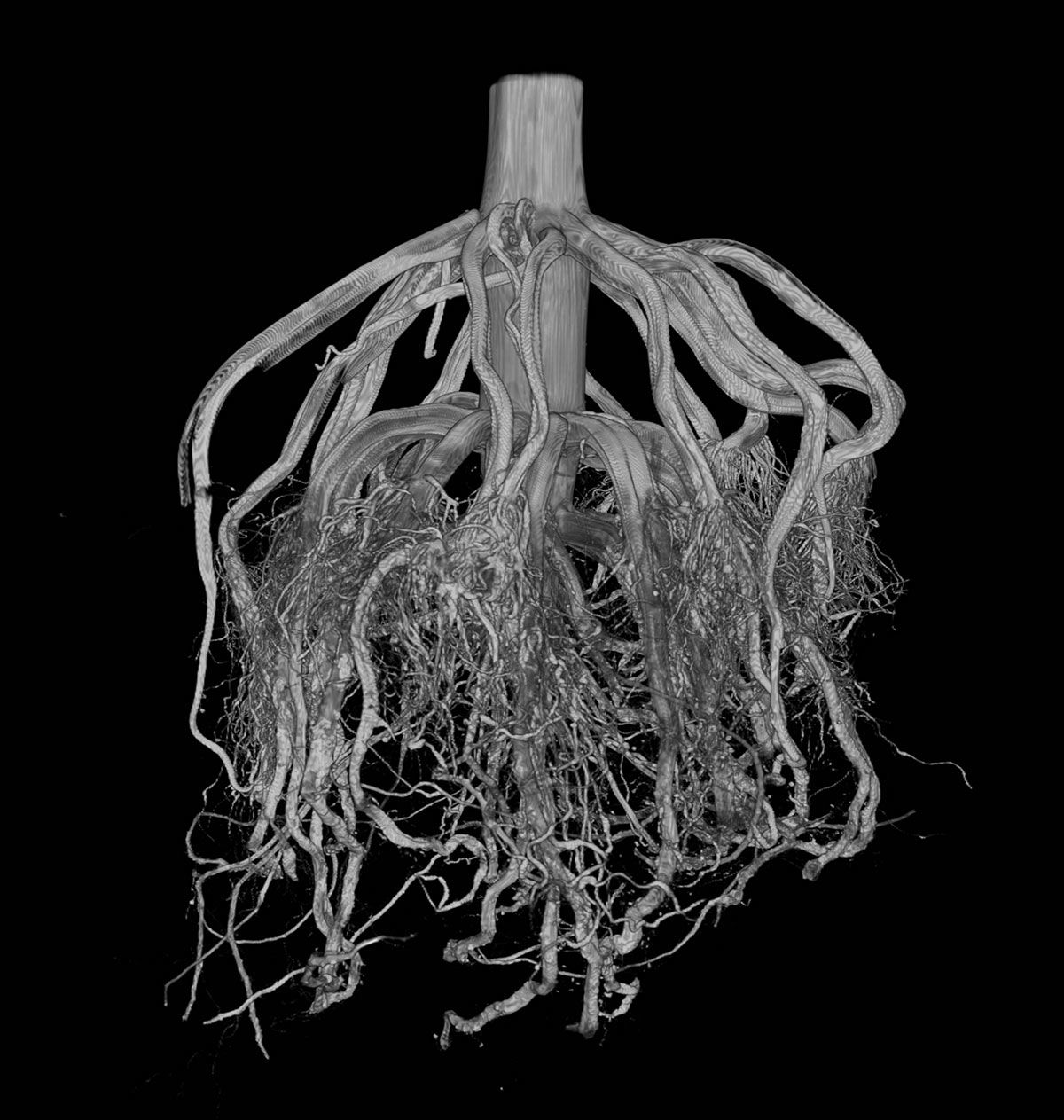 Danforth X-ray CT